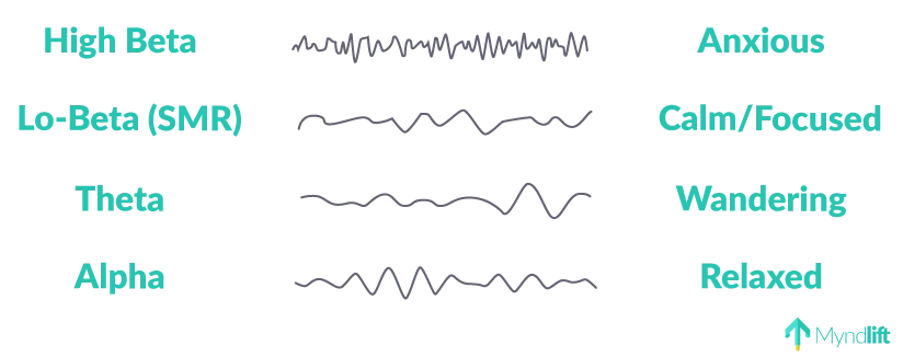 About Neurofeedback About Neurofeedback